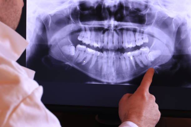 Best Emergency Broken Tooth Repair in Greenfield, IA